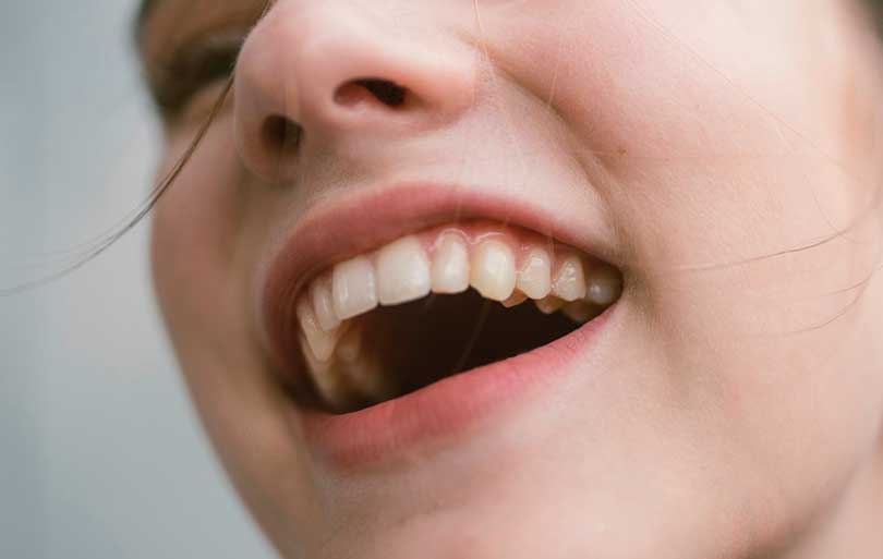 Limitado canal Chaise longue Anatomía de la boca. Las partes de la cavidad bucal | EOC