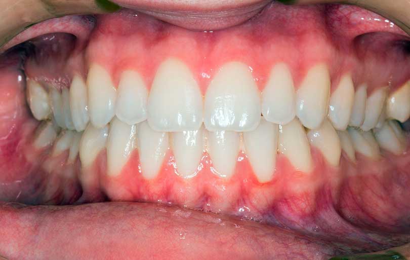 anatomia de la boca