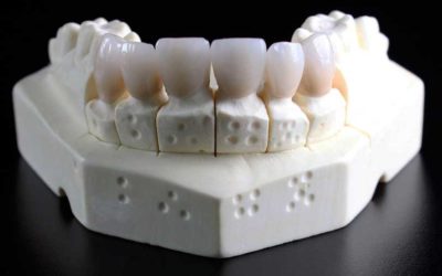 Composición química de los dientes humanos