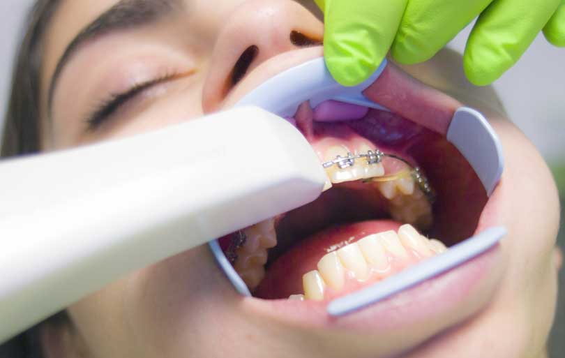 Estado Mejorar Exquisito Los músculos de la boca y sus funciones | EOC Barcelona